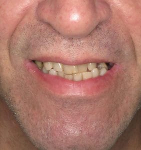 Clocktower Dental | Client Before & After Photos