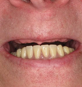 Clocktower Dental | Client Before & After Photos