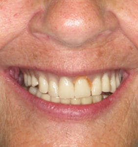 Clocktower Dental | Client Before & After Photos