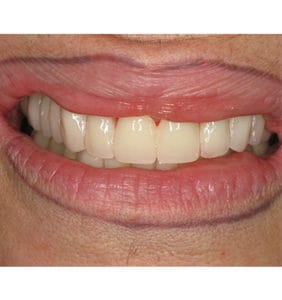 Clocktower Dental | Client Before & After Photos