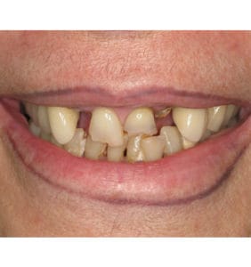 Clocktower Dental | Client Before & After Photos