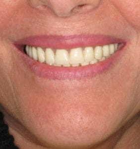 Clocktower Dental | Client Before & After Photos