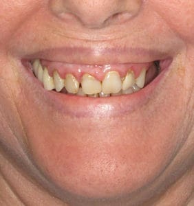 Clocktower Dental | Client Before & After Photos