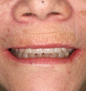 Clocktower Dental | Client Before & After Photos