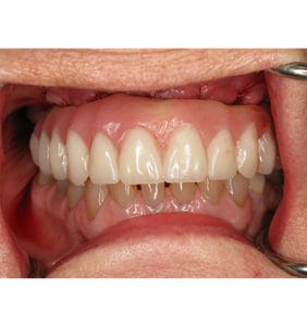 Clocktower Dental | Client Before & After Photos