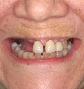 Clocktower Dental | Client Before & After Photos