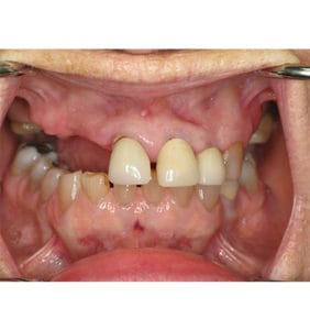 Clocktower Dental | Client Before & After Photos