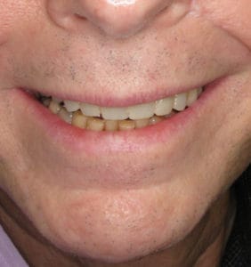 Clocktower Dental | Client Before & After Photos