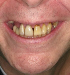 Clocktower Dental | Client Before & After Photos