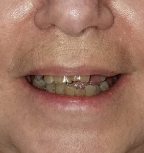 Clocktower Dental | Client Before & After Photos