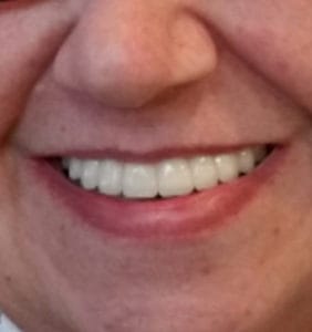 Clocktower Dental | Client Before & After Photos