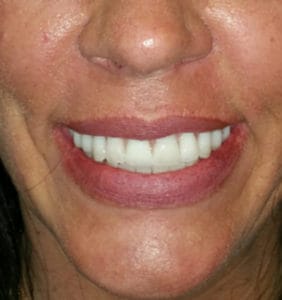 Clocktower Dental | Client Before & After Photos