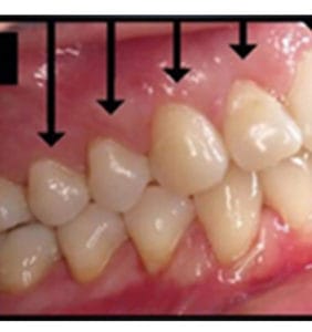 Clocktower Dental | Client Before & After Photos