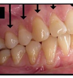 Clocktower Dental | Client Before & After Photos