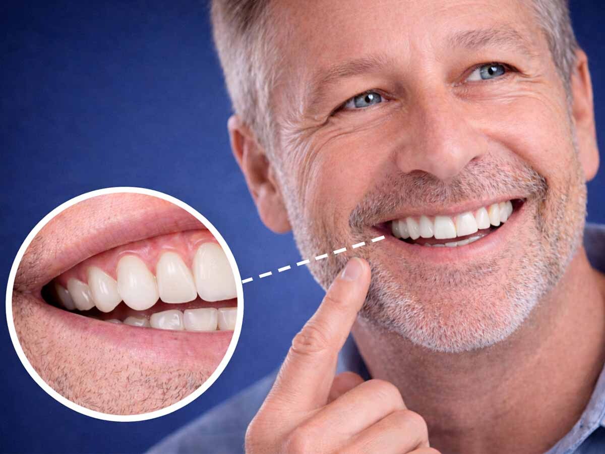 Smile in a Day Dental Implants Clock Tower Dental in Franklin Square