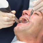 man getting dental work