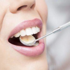 Woman getting a dental checkup