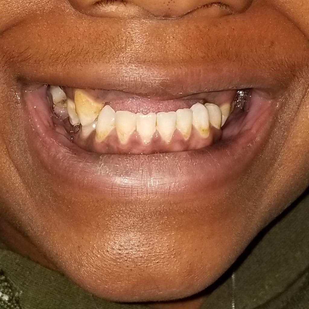 Smile Gallery Archive Page 2 of 14 Clock Tower Dental