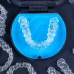 Invisalign