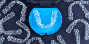 Invisalign