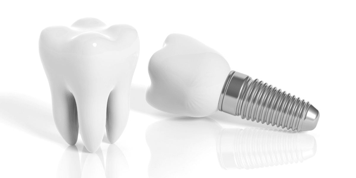 Why Dental Implants Aren’t as Painful as You May Think