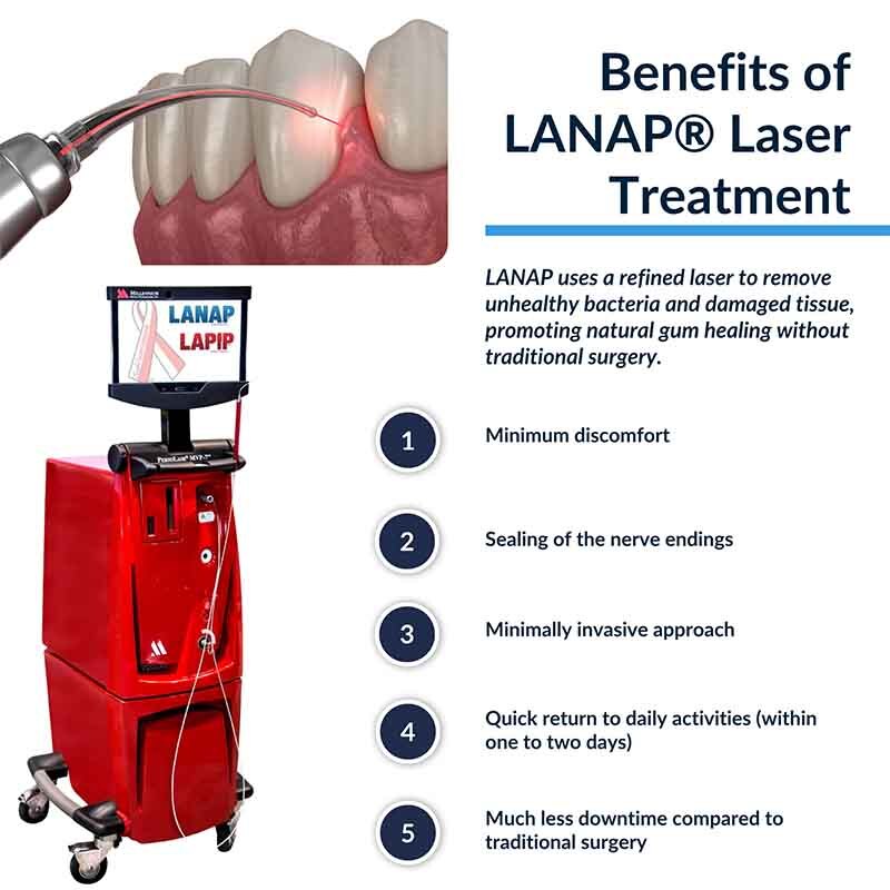 LANAP laser gum surgery infographic showing benefits of minimally invasive periodontal treatment and advanced dental laser technology