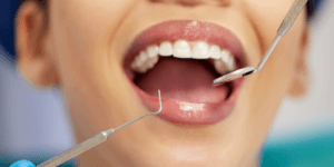 Dental Procedures