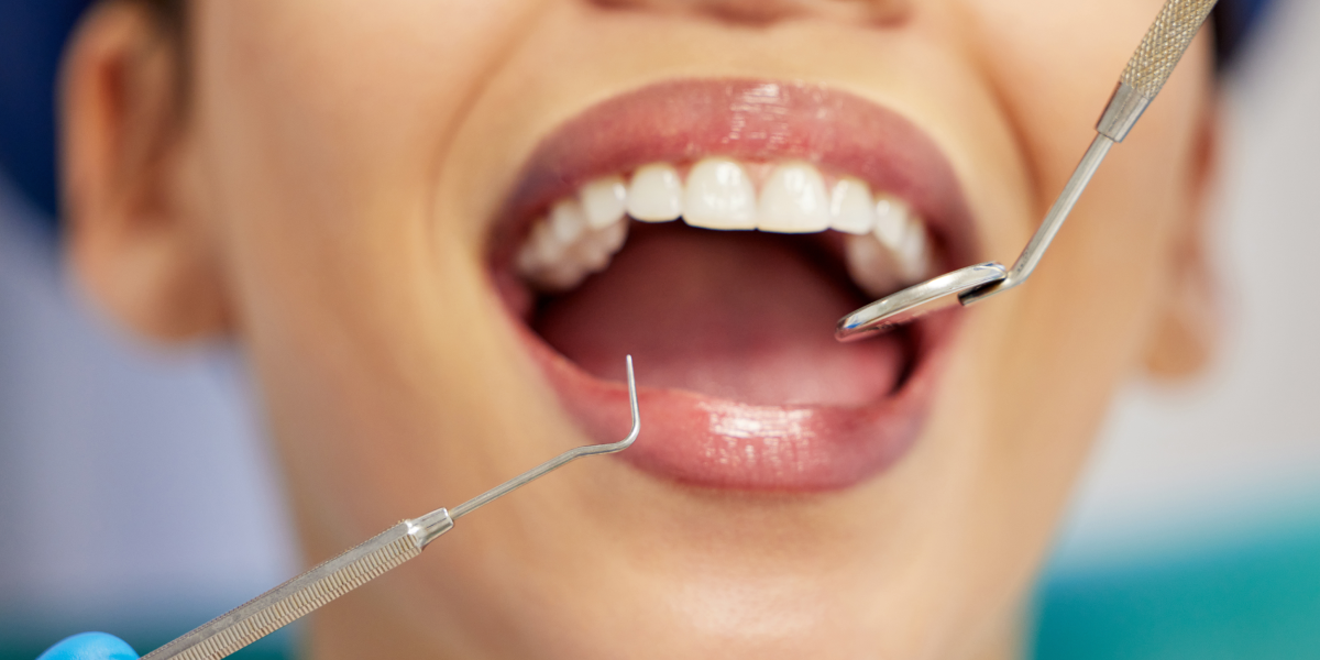Top Cosmetic Dental Procedures