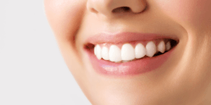 Perfect Teeth Smile