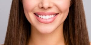 Woman with veneers