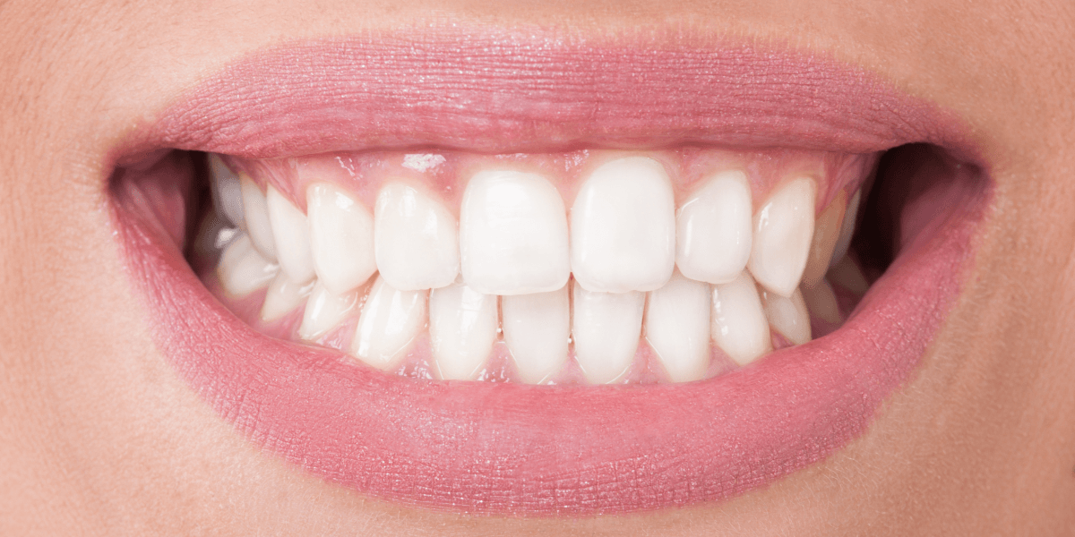 Oral Hygiene