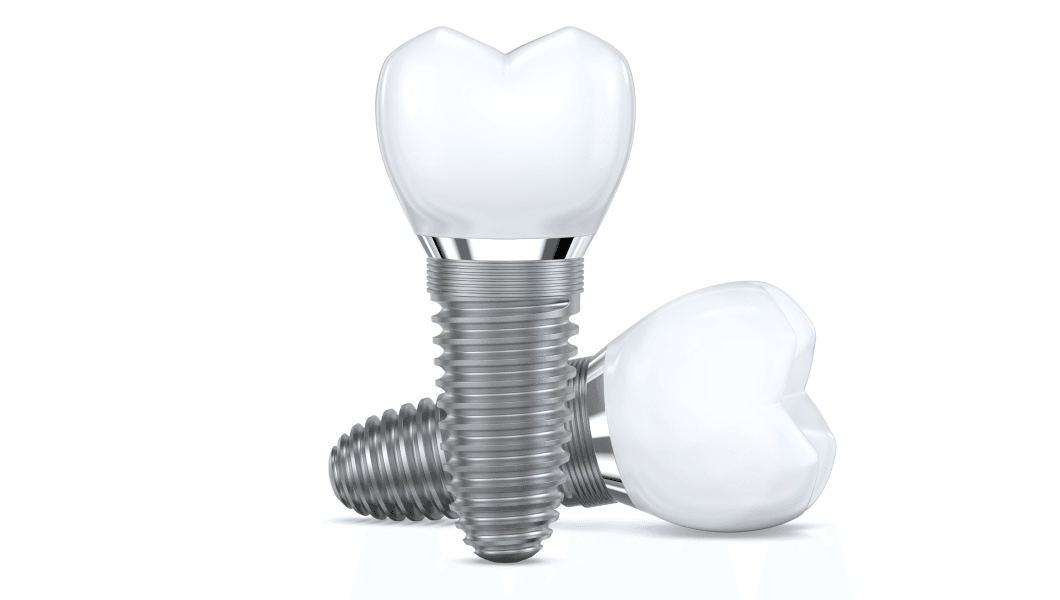Understanding Your Options Different Types of Dental Implants Clock Tower Dental Franklin Square