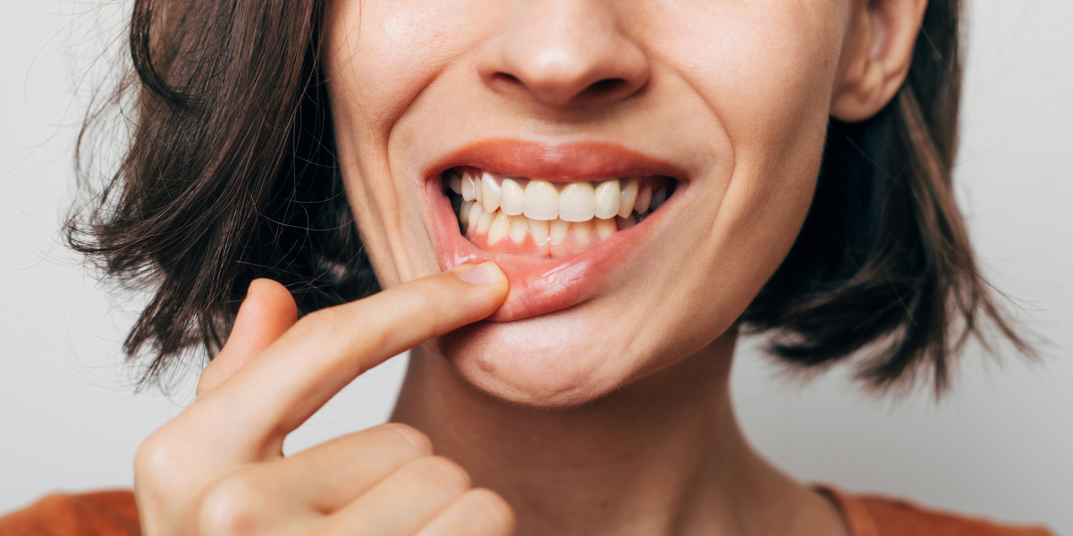 Oral Health Awareness: Getting to Know Your Gums