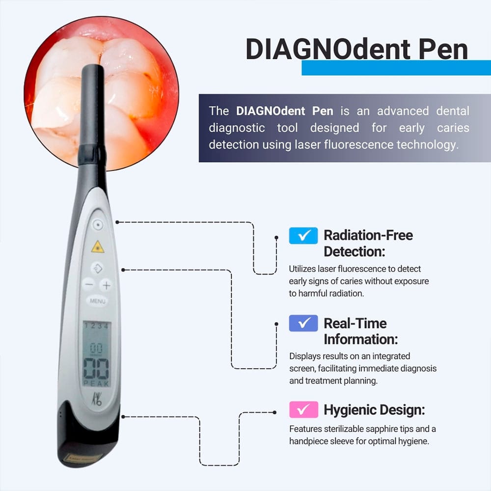 DIAGNOdent Pen at Clocktower Dental
