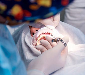 Oral Surgery Service