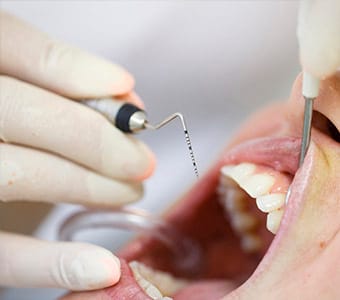 Periodontics Service