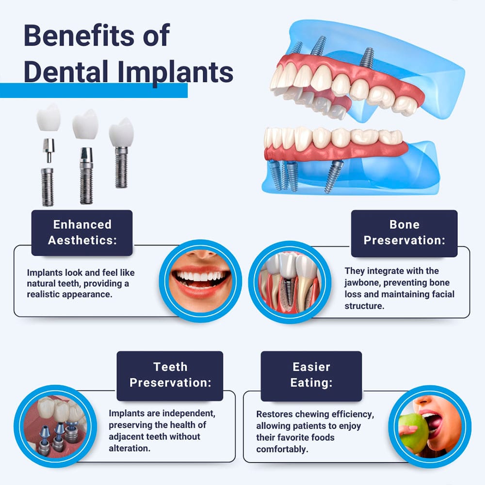 Benefits of Dental Implants