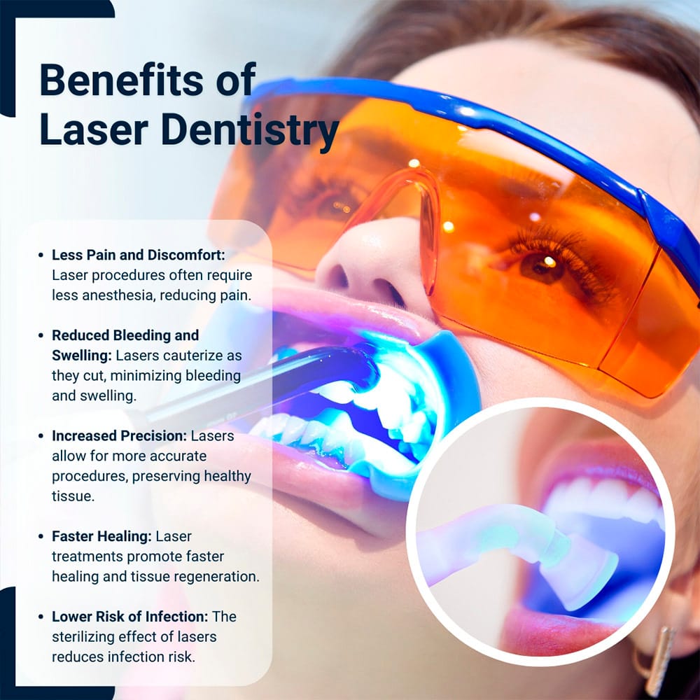 Benefits of Laser Dentistry