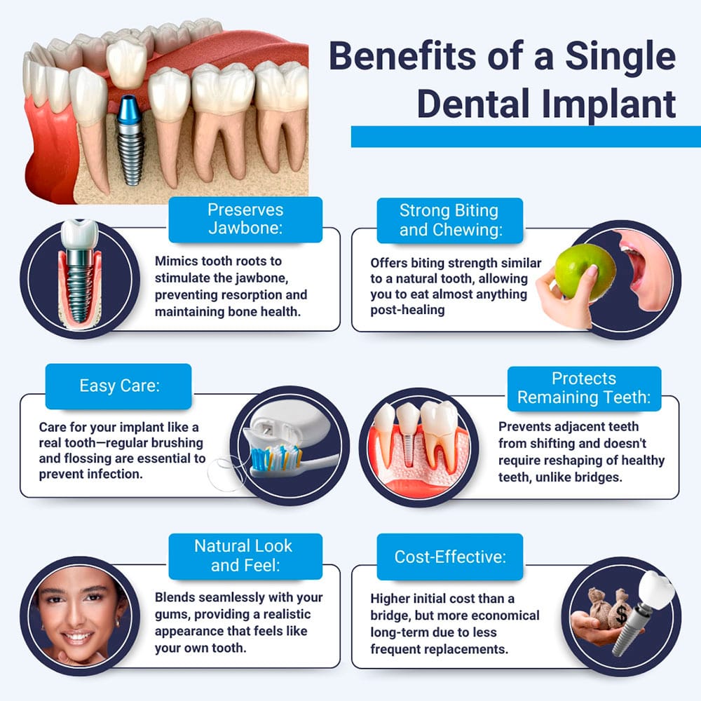 Benefits of Single Dental Implant