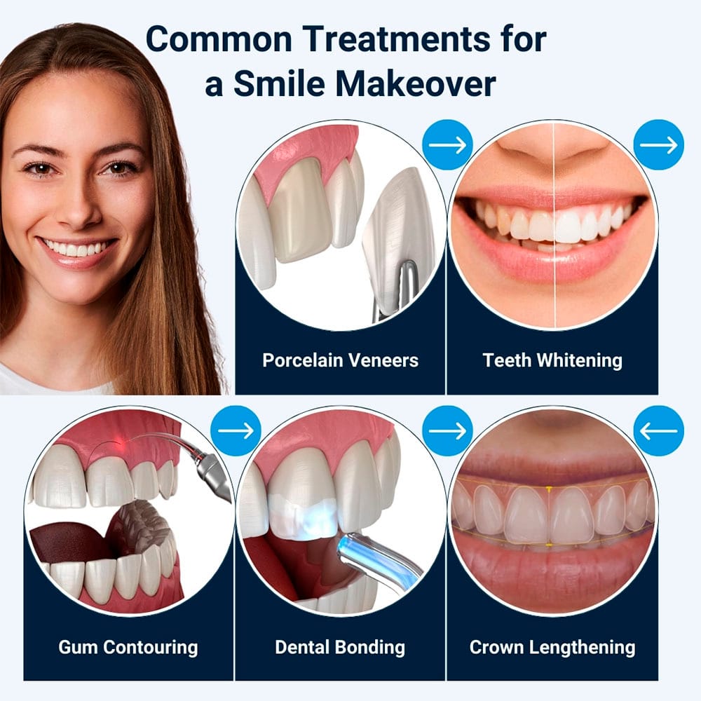Common Treatments for Smile Makeover