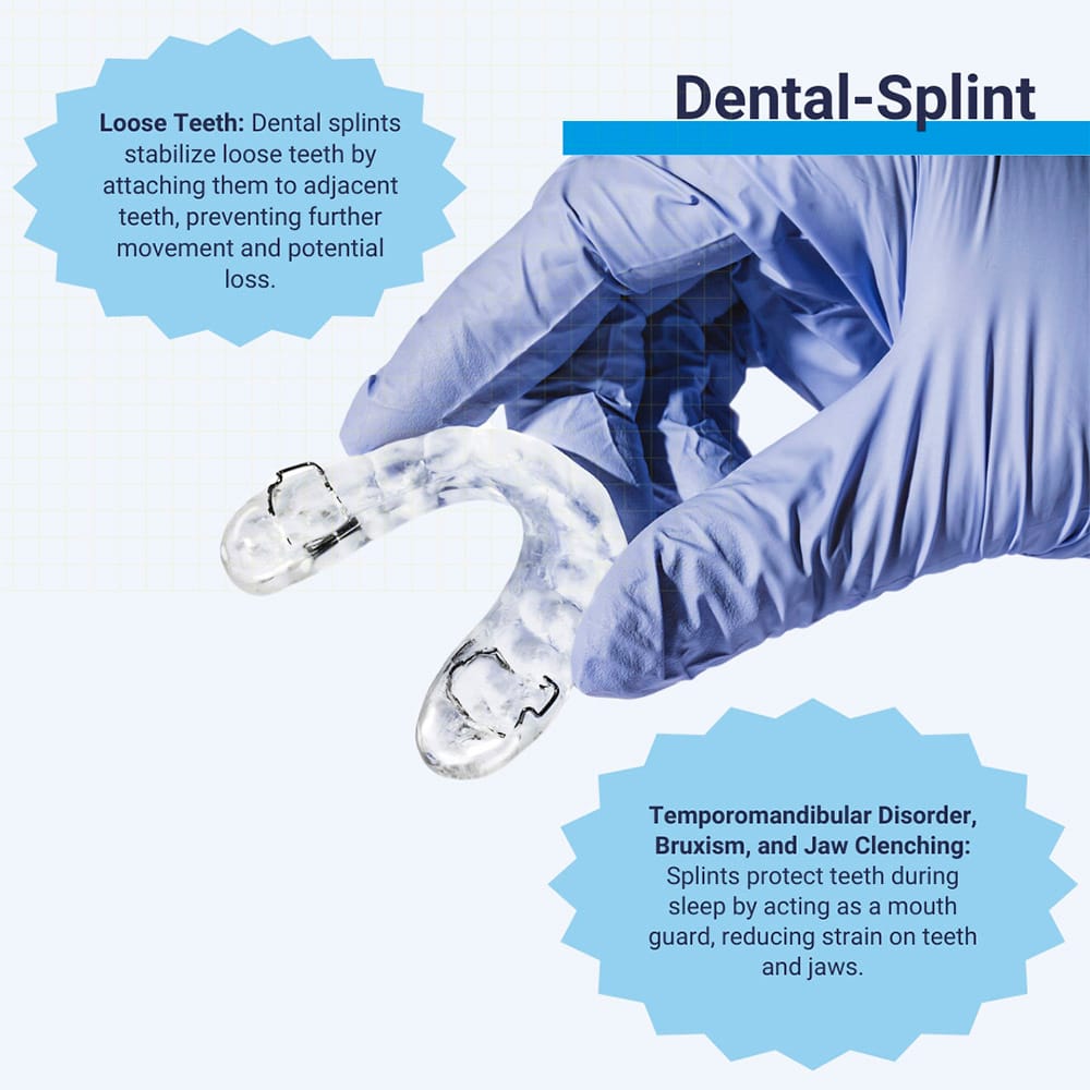 Dental Splint Usage