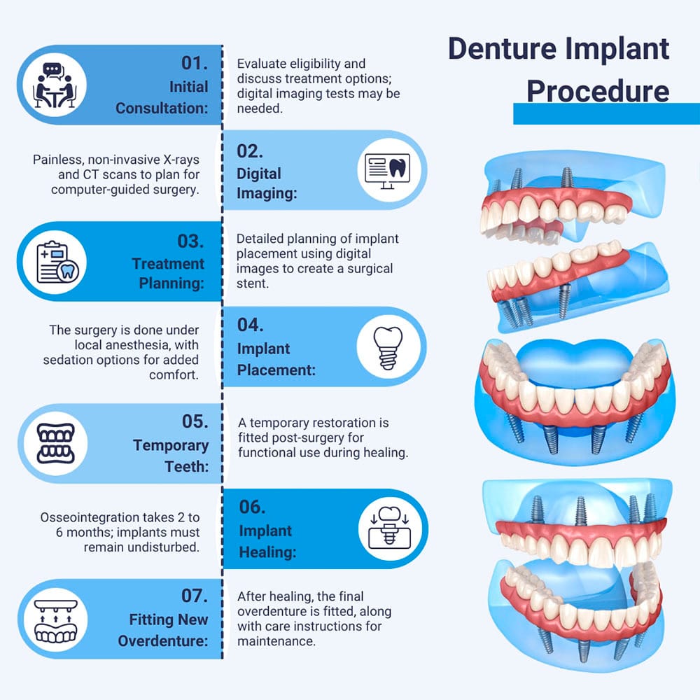 Denture Implant Procedure