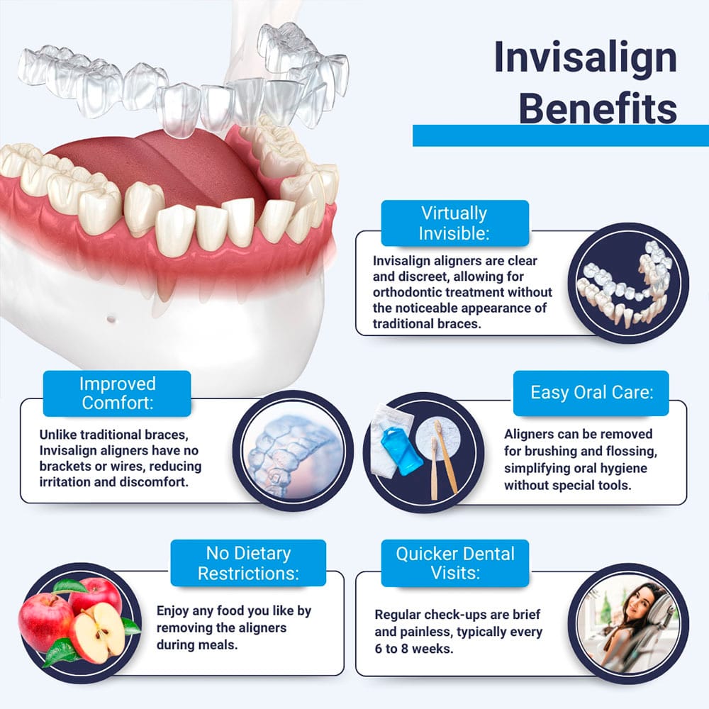 Invisalign Benefits