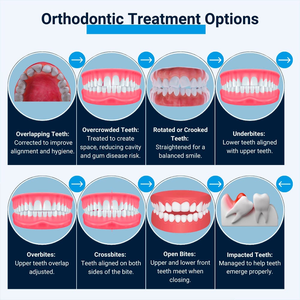 Orthodontic Treatment Options