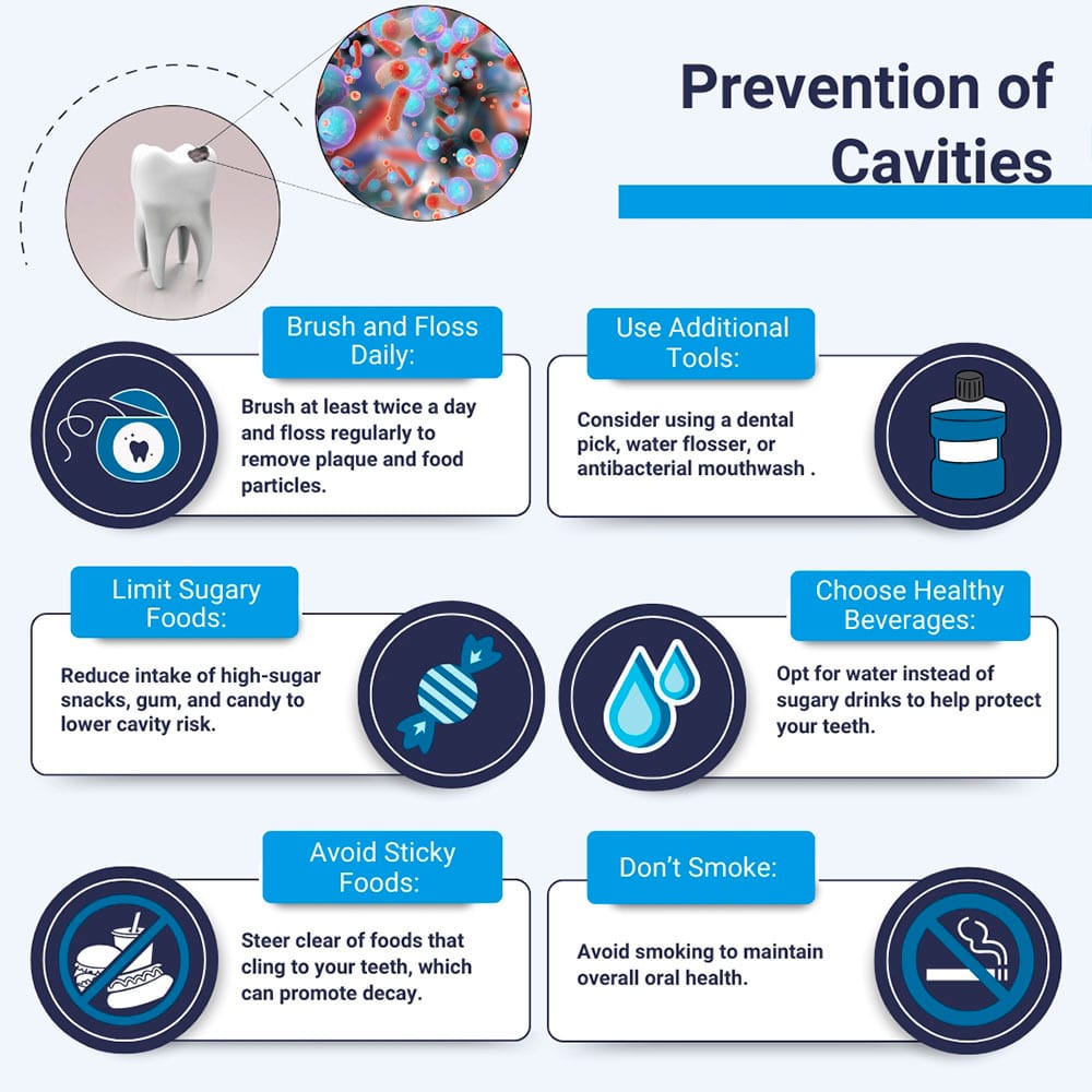 Prevention of Cavities