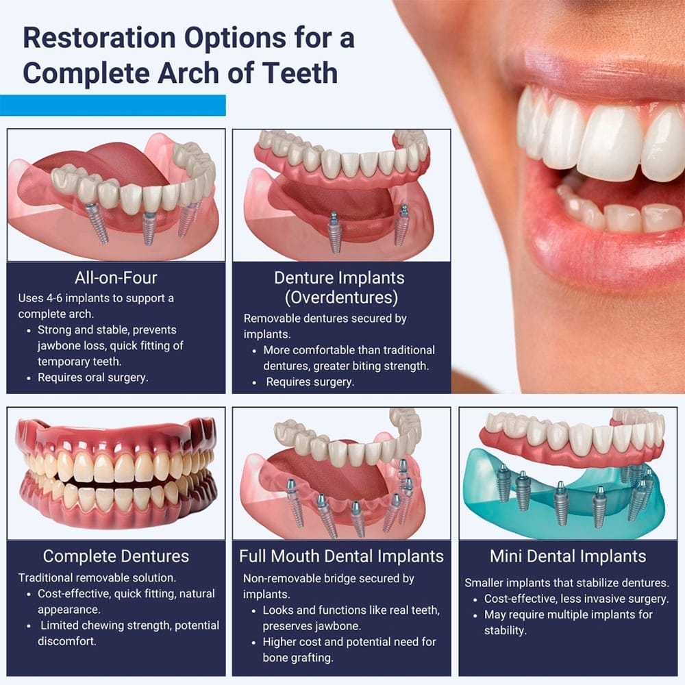 Restoration Options For a Complete Arch of Teeth