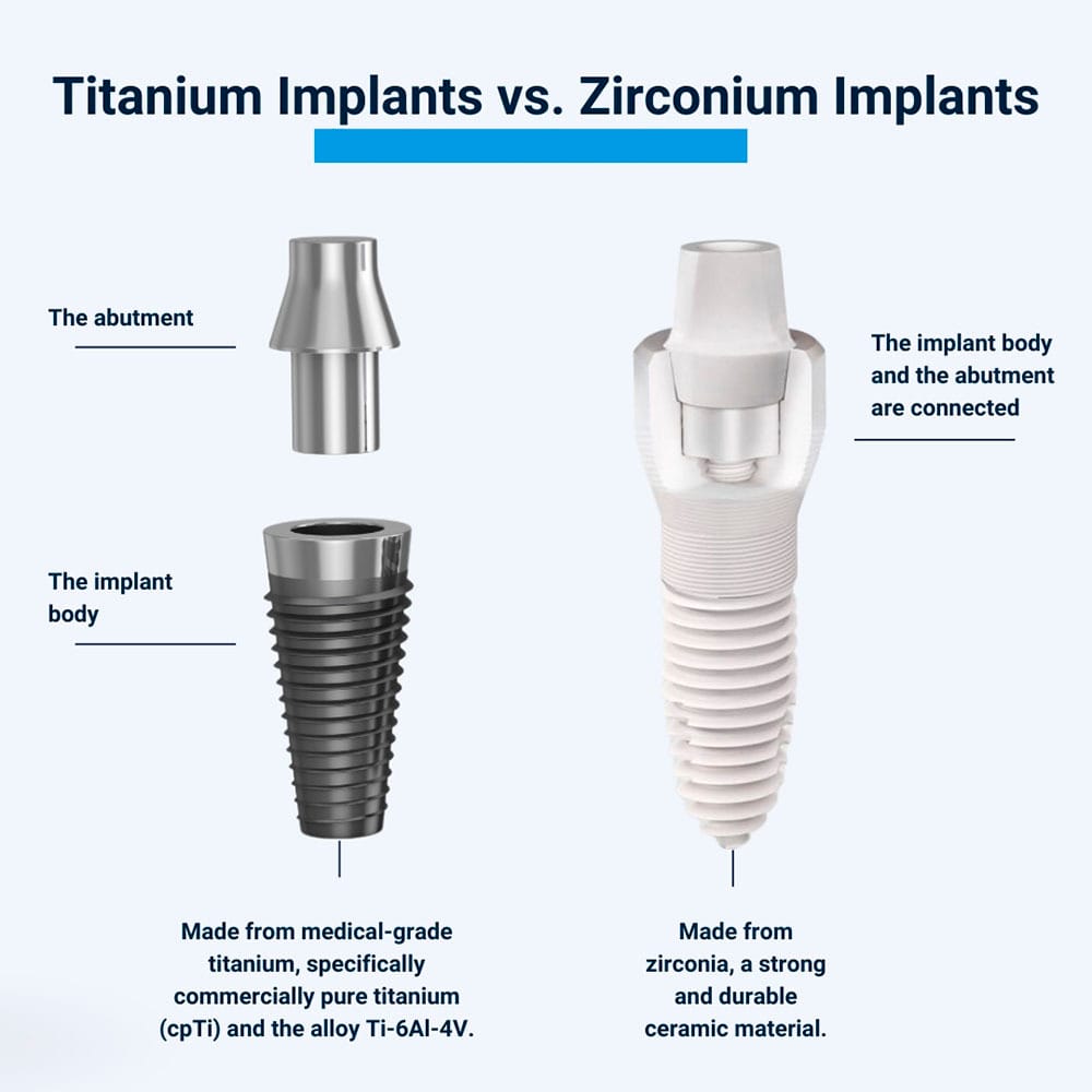 Titanium Implants vs Zirconium Implants
