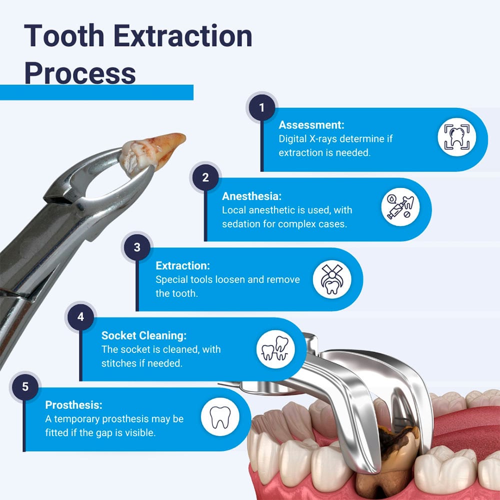 Tooth Extraction Process