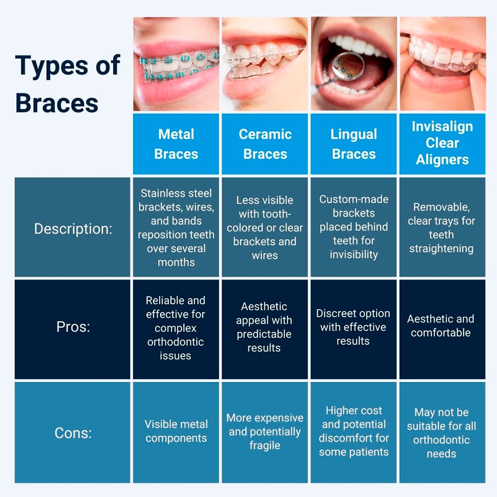 Types of Braces