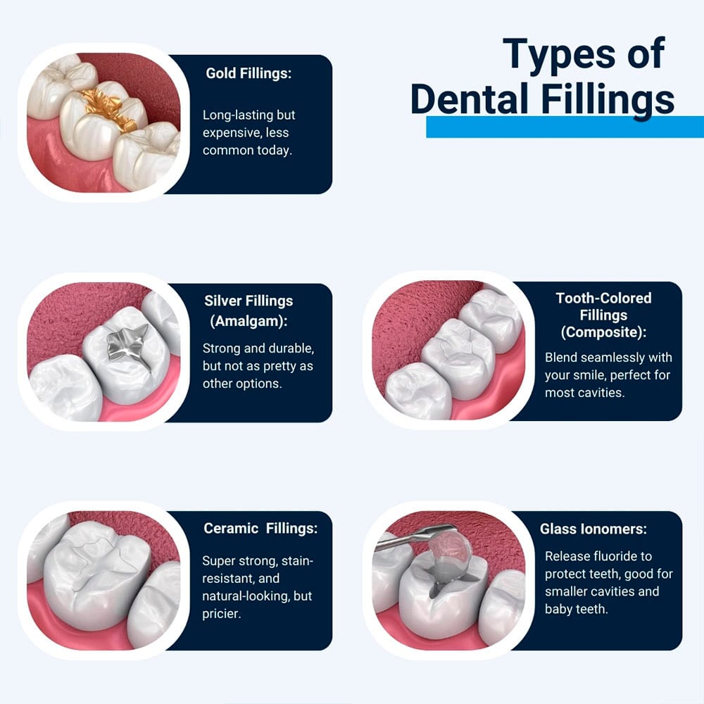Types of Dental Fillings
